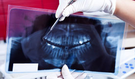 Best Dentist Ooltewah TN